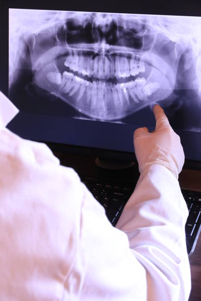 Best Emergency Wisdom Teeth Removal in Walce, LA